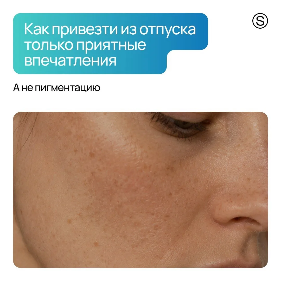 Ситуация: клиент исправно берет SPF в отпуск и активно им пользуется, но возвращается с новыми пятна
