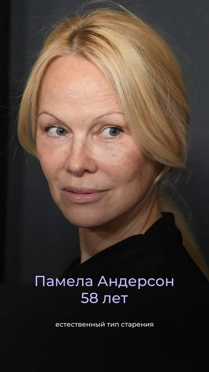 Стареть с косметологией или без? Смотрим, как это может выглядеть🔍