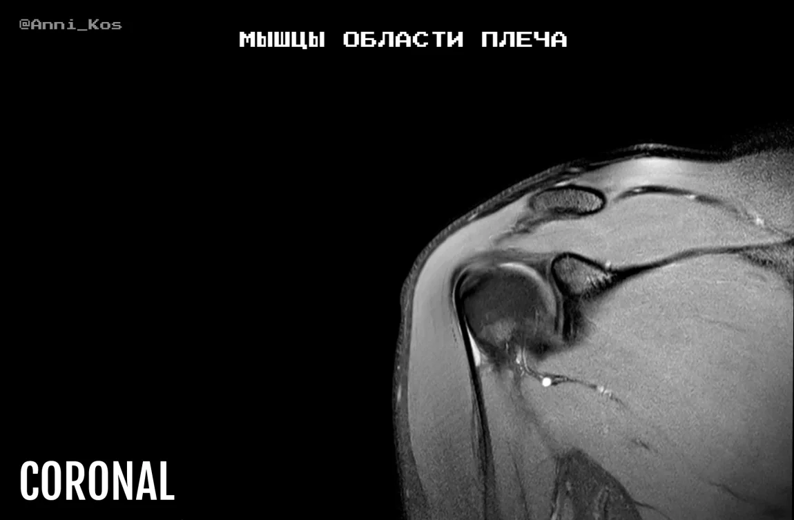 Шикарные карточки по МР-анатомии мышц пояса верхней конечности🔥