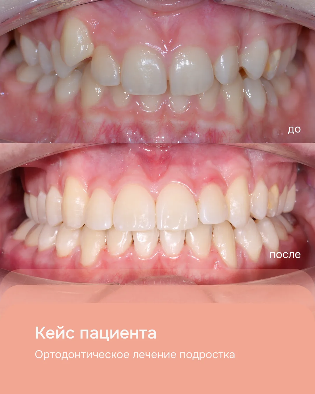 #истории_пациентов