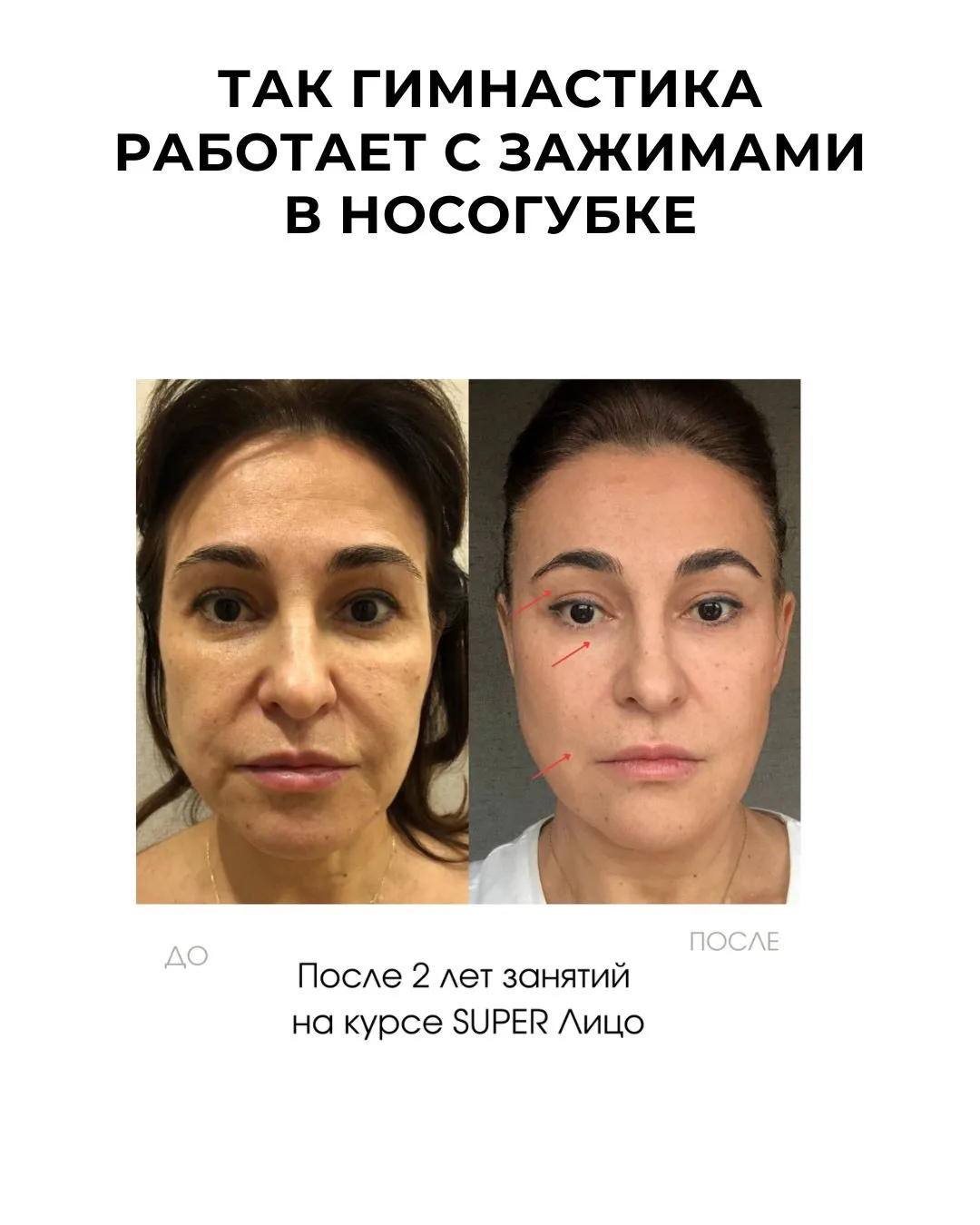 Изображение 4 к публикации «Гимнастика для лица»