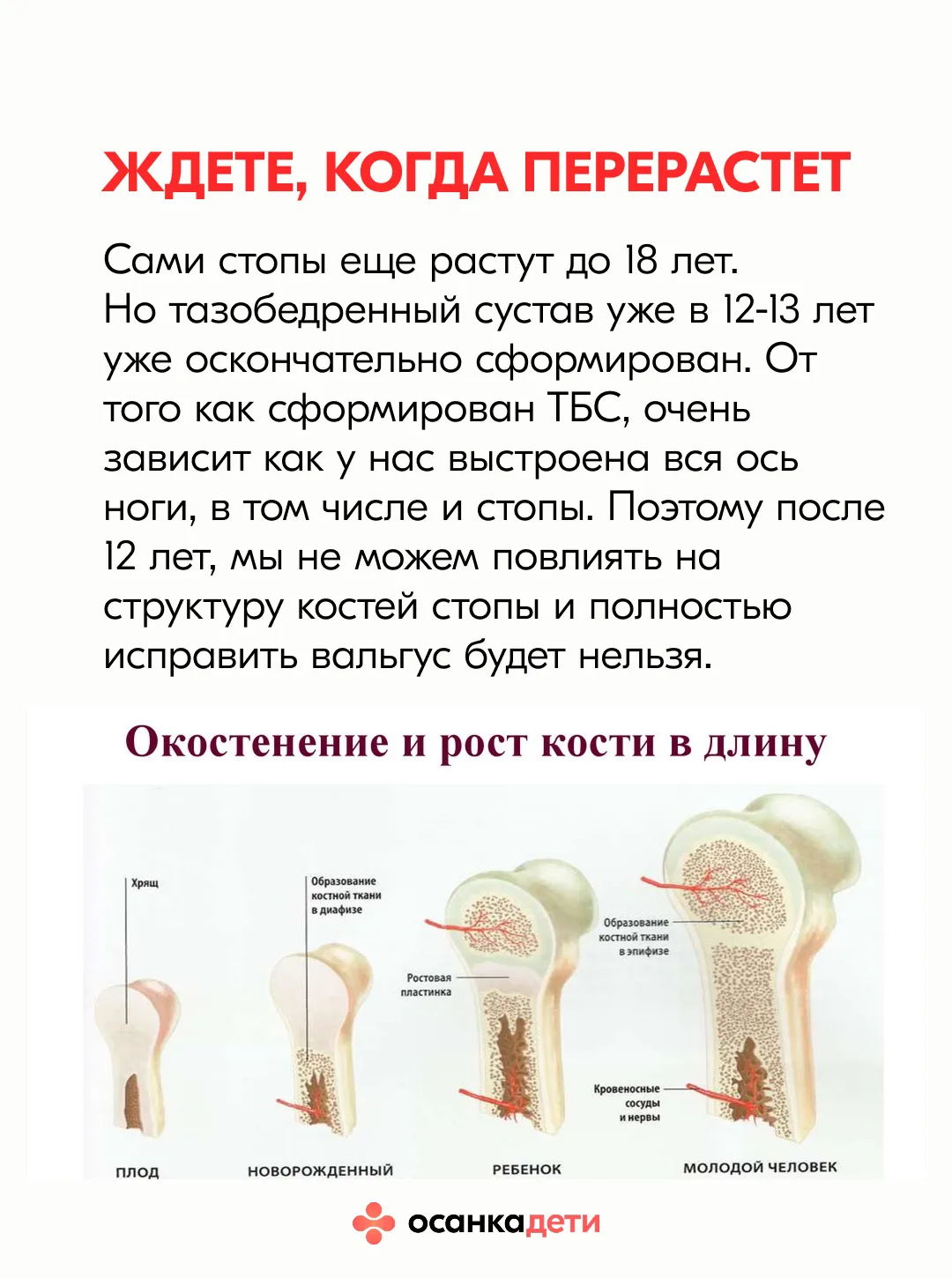 Что МЕШАЕТ исправить вальгус (и почему вы до сих пор топчетесь на месте)  «Мы уже год в ортообуви — 