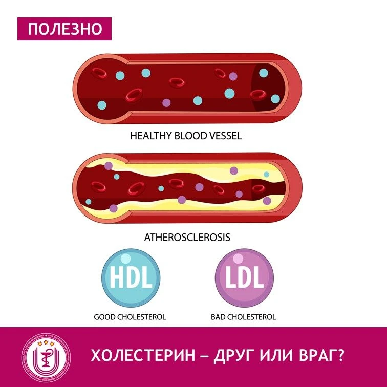 В мире здоровья часто звучит слово "холестерин", и, как правило, с негативным оттенком....
