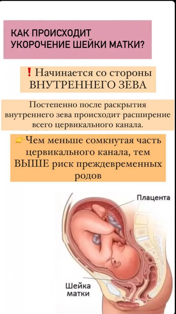 🔴ИЦН