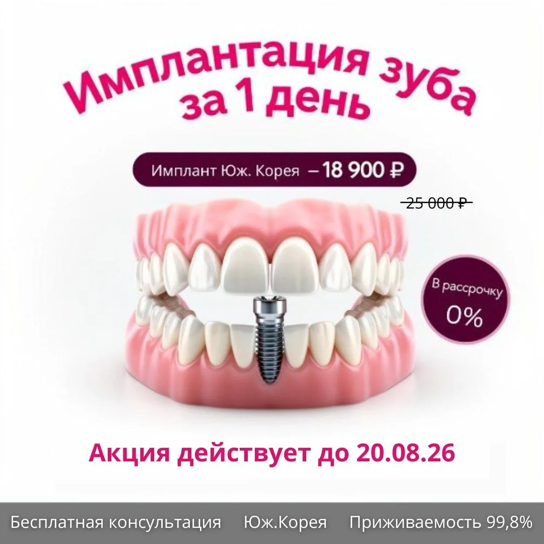 ✨ Имплантация за 1 день — всего 18 900 ₽ вместо 25 000 ₽