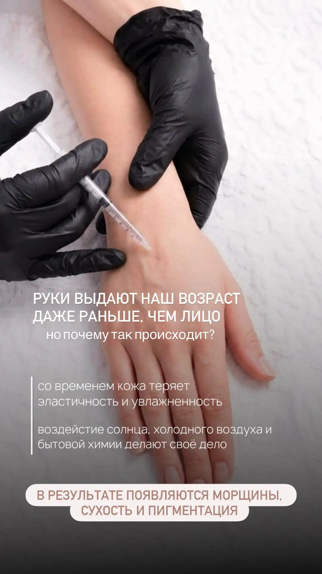 💉 Биоревитализация рук: верните коже молодость