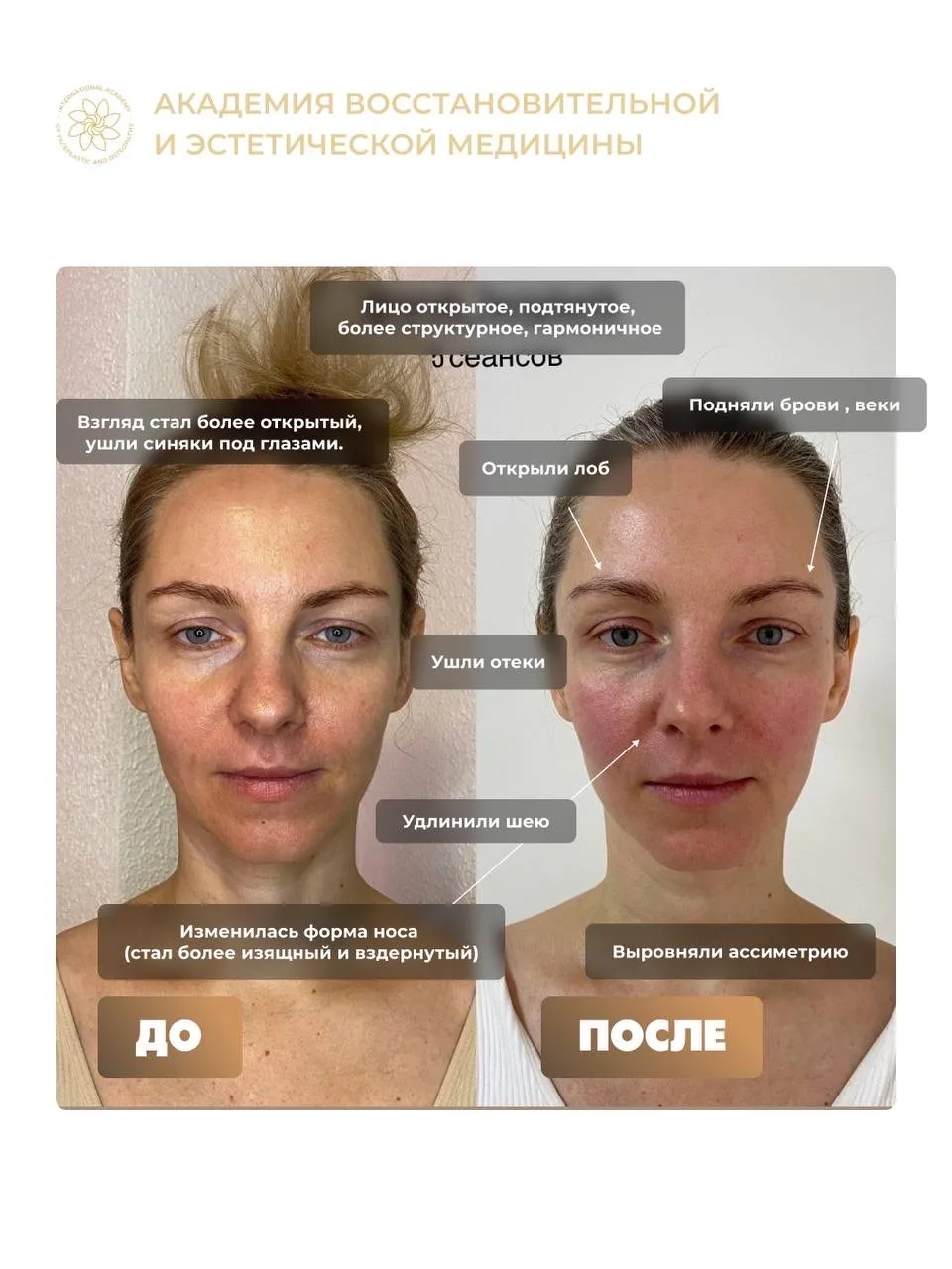 ❌ NO ОГРАНИЧЕНИЯМ! Из найма в фuнaнсовую свободу, признание и счастье 🤩  Сегодня расскажем про вдохн