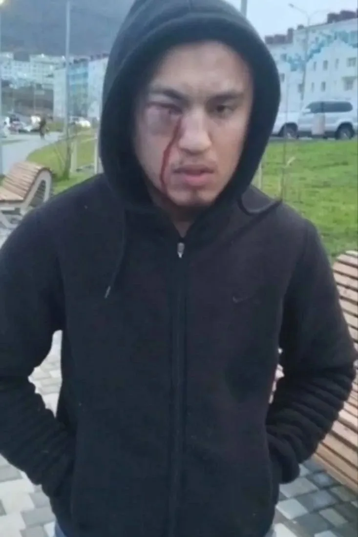 Что с лицом?