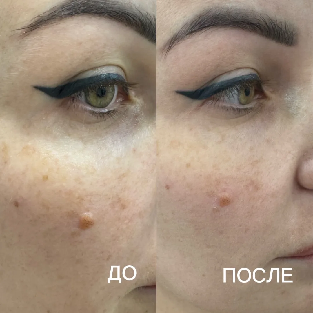 5 признаков, что коже пора помочь после лета