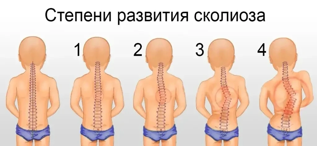 Правильная осанка – это здоровье и уверенность в себе