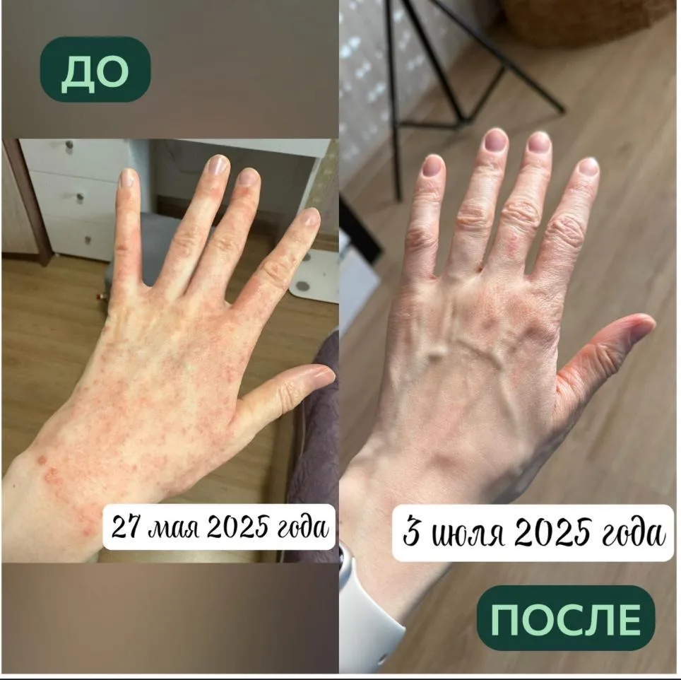Как убрать воспаление в ЖКТ и не сделать себе хуже   Если вы годами живете со вздутием, тяжестью, пр