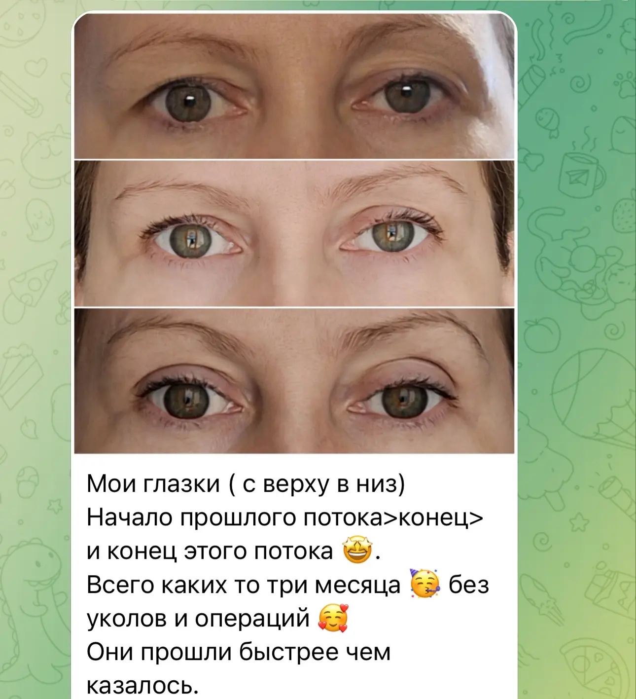 +1 счастливая женщина 🔥и поднятые веки без операций и вреда себе 😎🪄