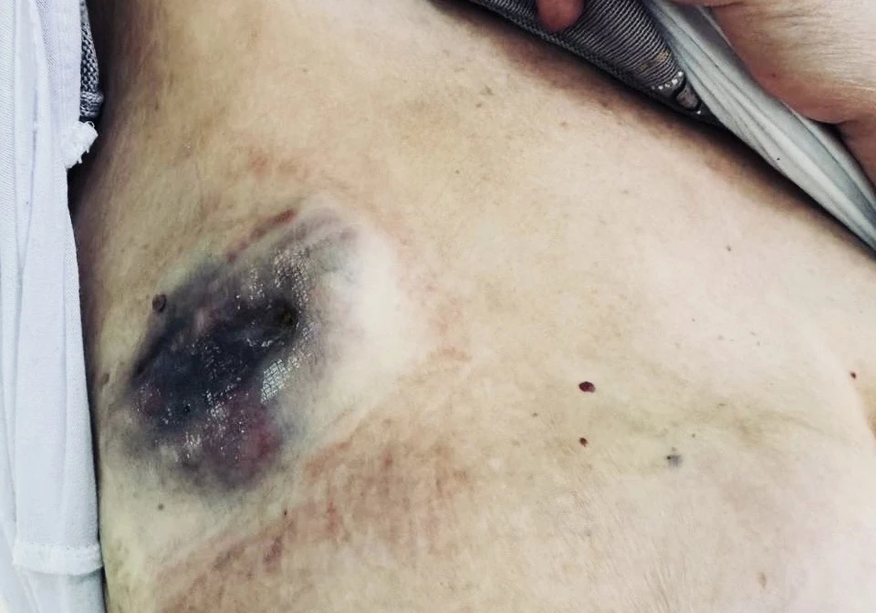 😨 Жительница Бурятии пыталась вылечить рак мазями

В онкологическом диспансере Бурятии показали стр