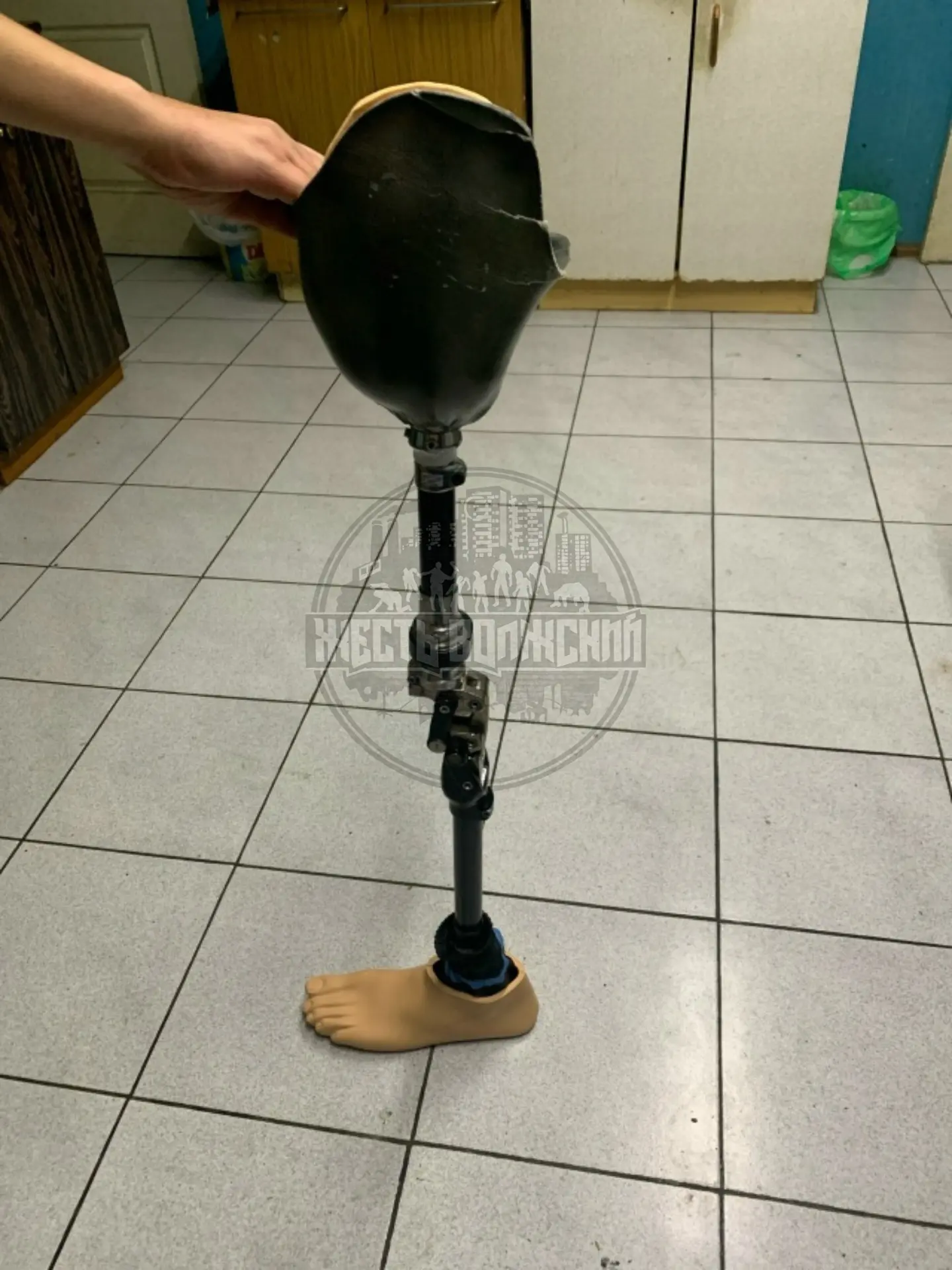 Кто потерял свою конечность?