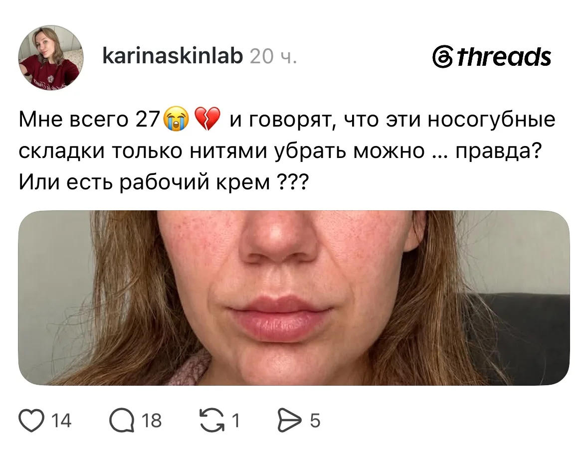 Тест на бьюти-эрудицию: какие процедуры помогут девушке убрать носогубные складки?