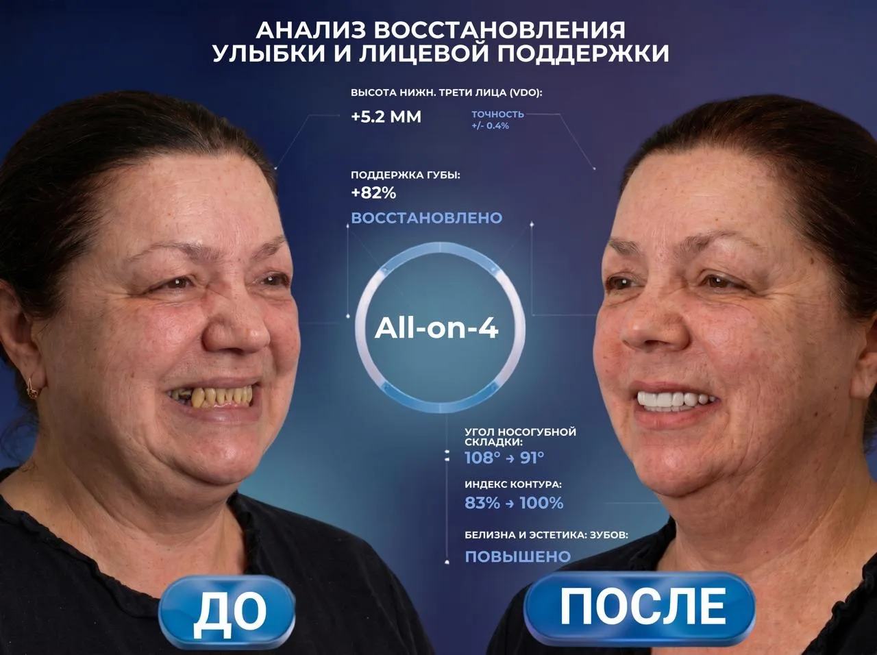 Как вернуть радость жизни и молодую улыбку всего за 1 день?