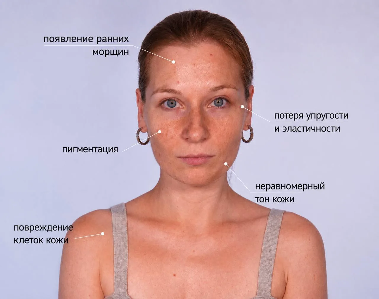 😱Не для слабонервных!
На фото выше: что было бы с моим лицом без SPF.

Мы часто слышим, что наше по
