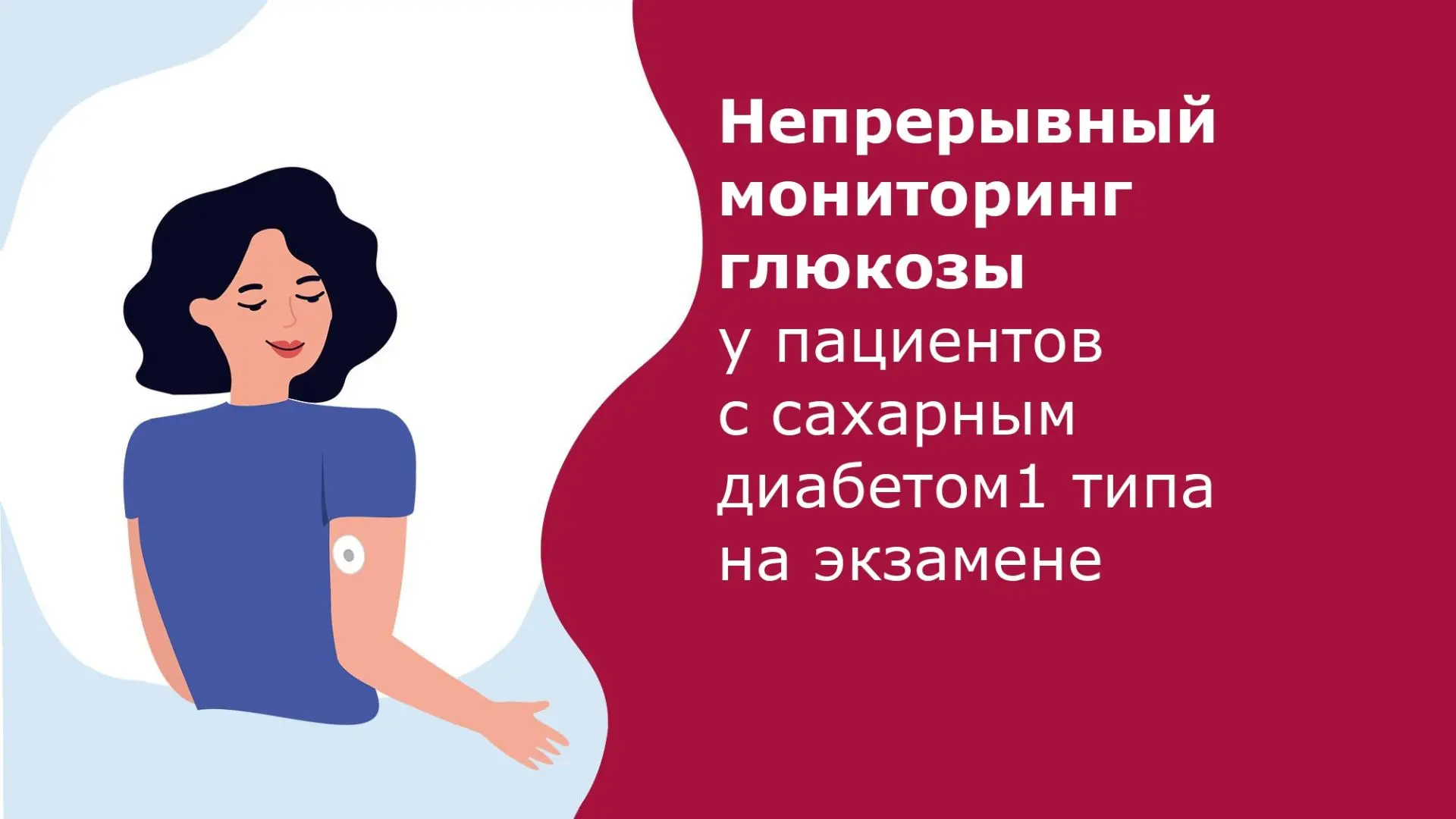 Непрерывный мониторинг глюкозы у пациентов с сахарным диабетом 1 типа на экзамене.