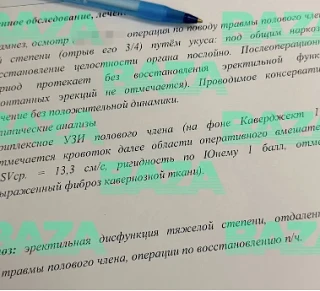 😱Причиной кровавого укуса за половой орган москвича стал эротический сон.