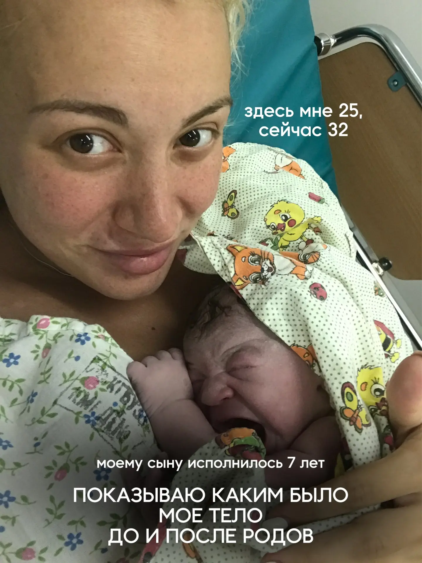 Вот почему фотография через неделю после первых родов вообще не про «повезло с генетикой»