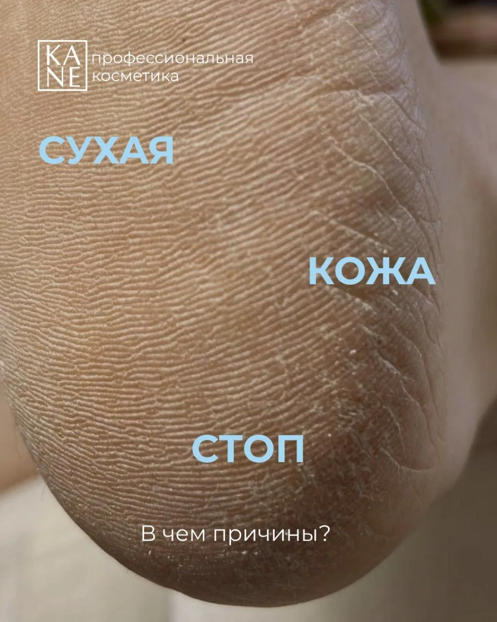 Почему кожа стоп сохнет и что ей в этом поможет? 

 ➡ Ссылка на увлажняющий крем для стоп от KANE