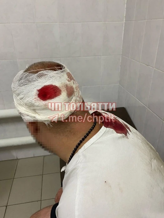 "Выскочили три урода": в Тольятти на улице Юбилейной пешеходу проломили голову

Фото: Неизвестные аг