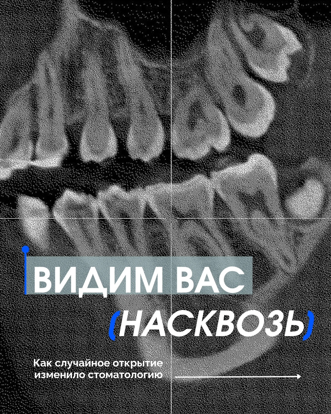 Сегодня снимок зуба занимает считаные секунды. А первый в истории стоматологический рен...