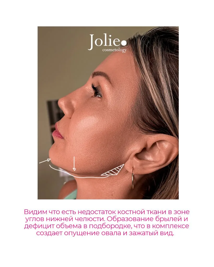 Изображение 2 к публикации «Центр косметологии Jolie»