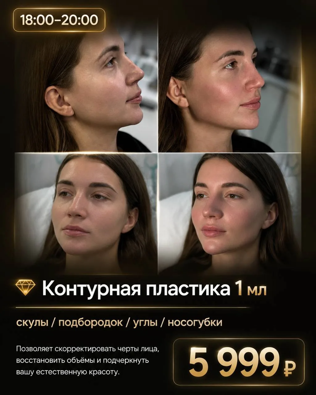 💎 Контурная пластика 1 мл
скулы / подбородок / углы / носогубки

5️⃣9️⃣9️⃣9️⃣

✨ Лот для тех, кто х