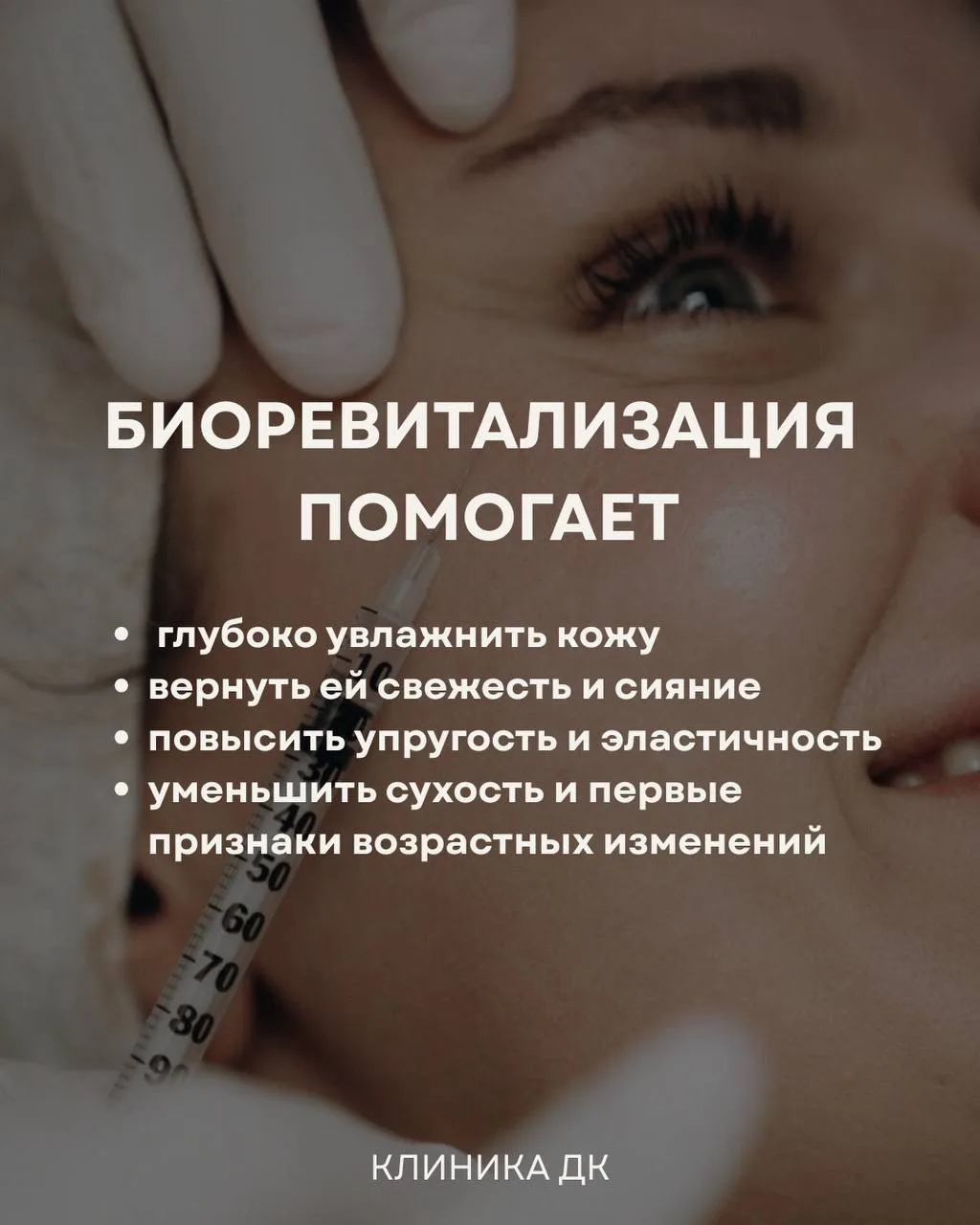 Весь август — скидка 10% на все процедуры биоревитализации у Анастасии!