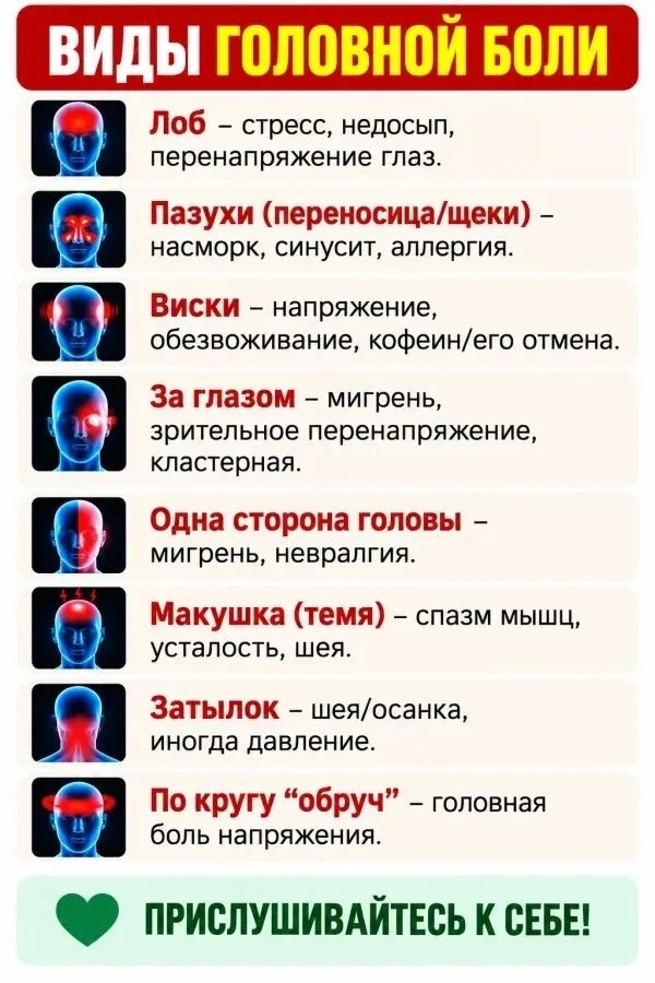 Основные типы боли по зонам головы 🤕