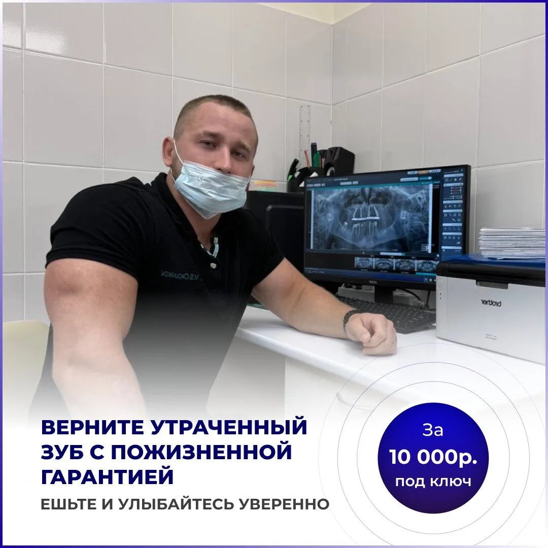Имплантация зубов за 1 день по акции в Екатеринбурге!