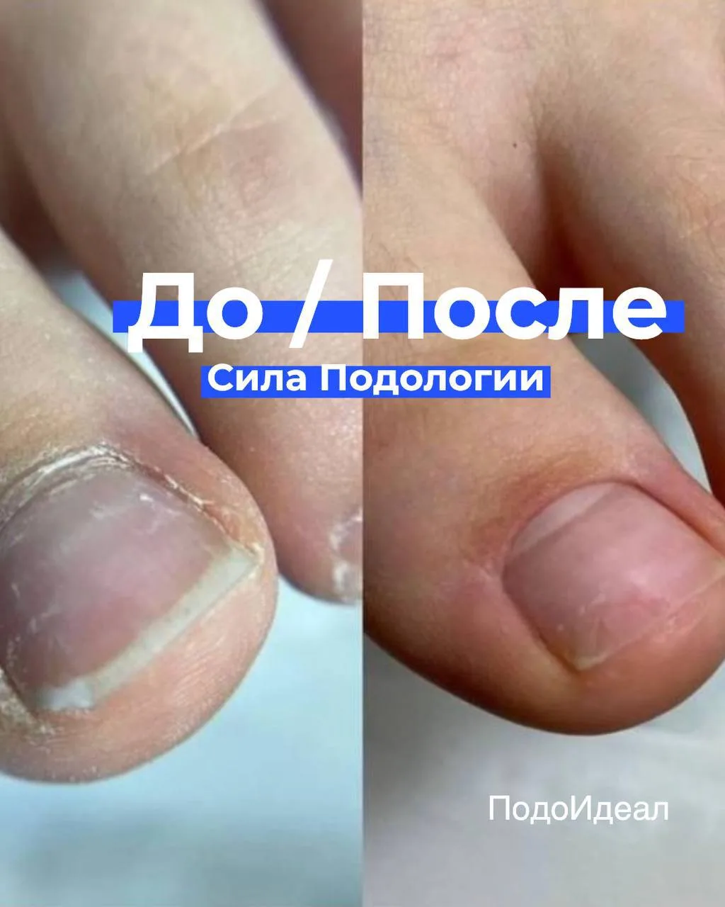 До // после