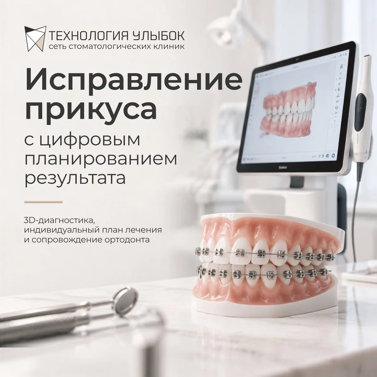 Исправление прикуса в «Технологии улыбок»