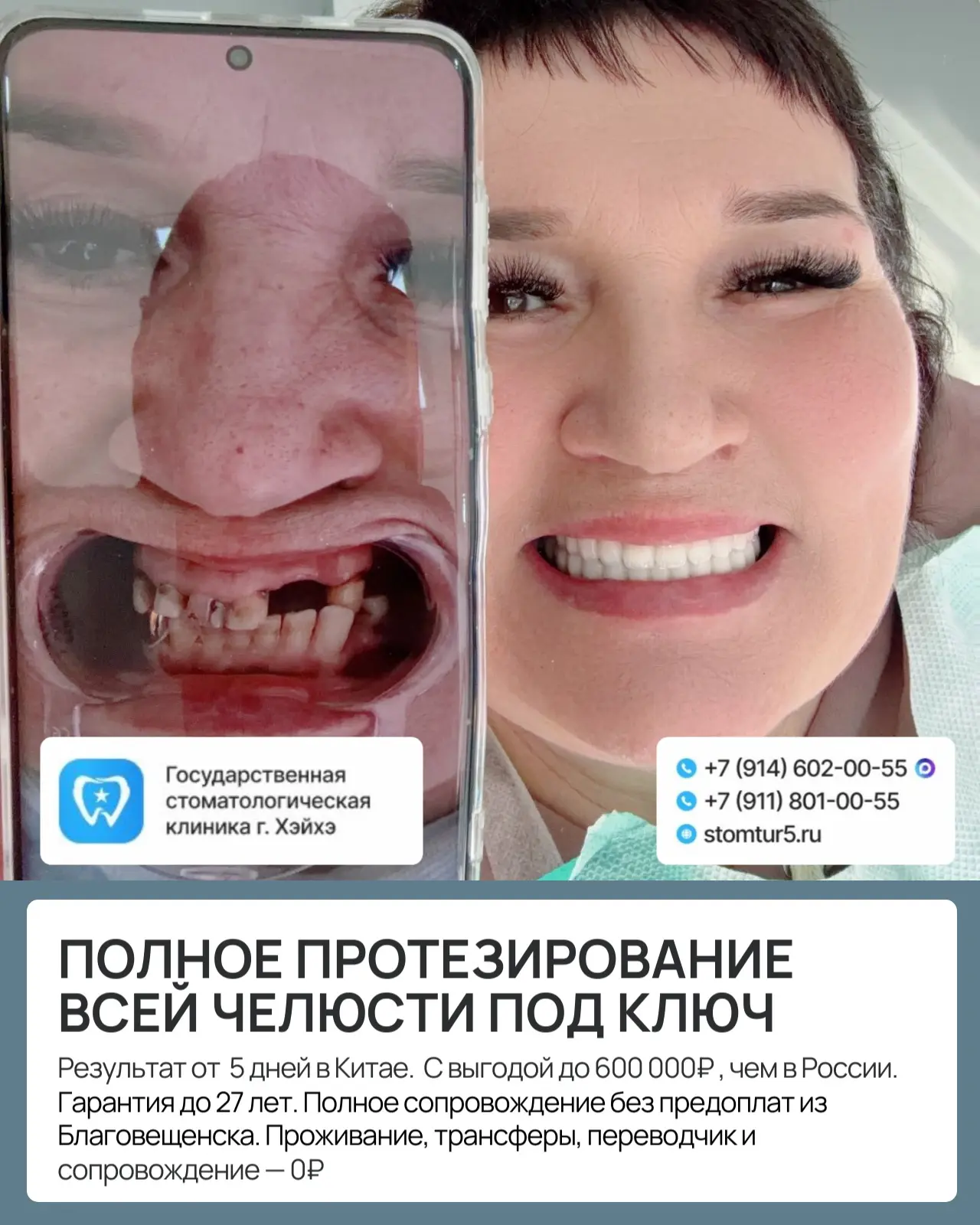 🌟Наглядно описанные результаты лечения наших пациентов в Государственной стоматологиче...