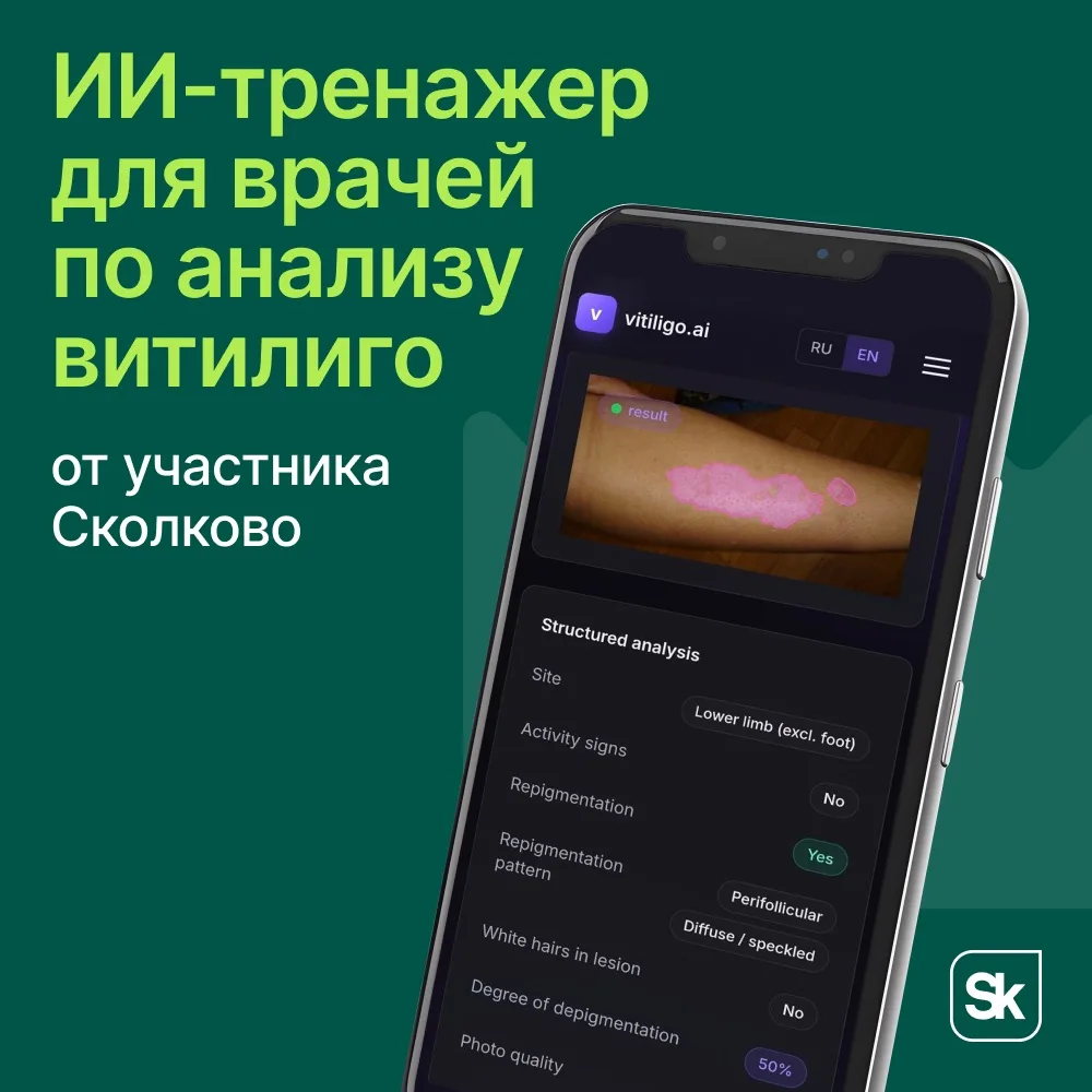 🏥 Резидент Сколково создал ИИ-тренажер для врачей по анализу витилиго.
 
Биотех-студия Scanderm раз