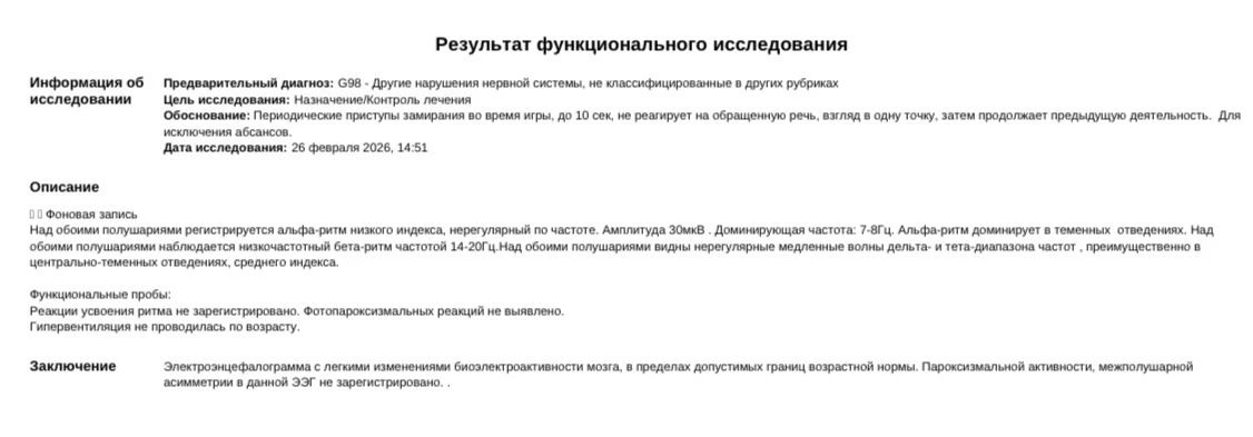 Когда «чистая» ЭЭГ не означает, что можно успокоиться

Ко мне на разбор попало ЭЭГ малыша 1 года 8 м