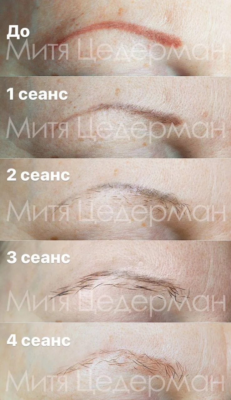 Каждый приемный день мы работаем с красными бровями, губами, татуировками и получаем во...