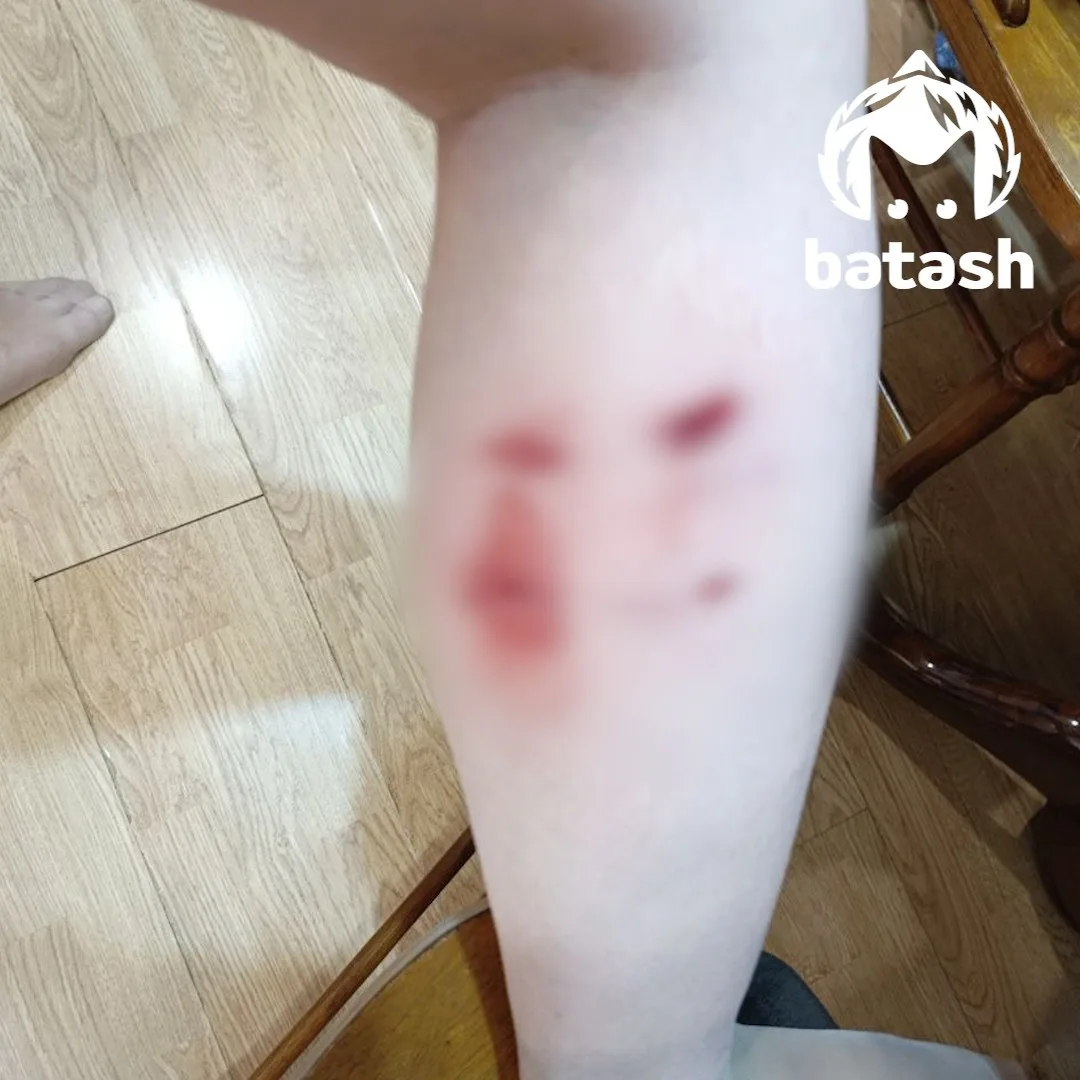 Стая бродячих собак набросилась на женщину в Черниковке.

По словам уфимки, она возвращалась с работ