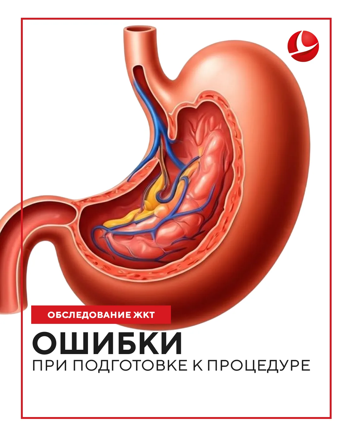 Главные ошибки пациентов при подготовке к процедурам 🚫