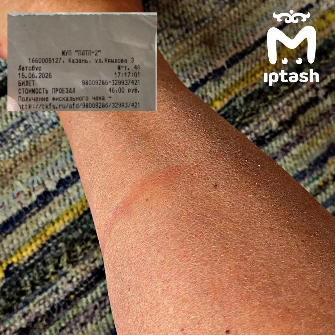 🥵 Пассажирка обожгла ногу в автобусе в 30-градусную жару