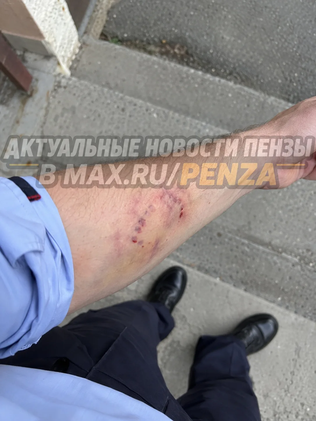 Пензячка укусила участкового и ударила его по лицу на проспекте Победы