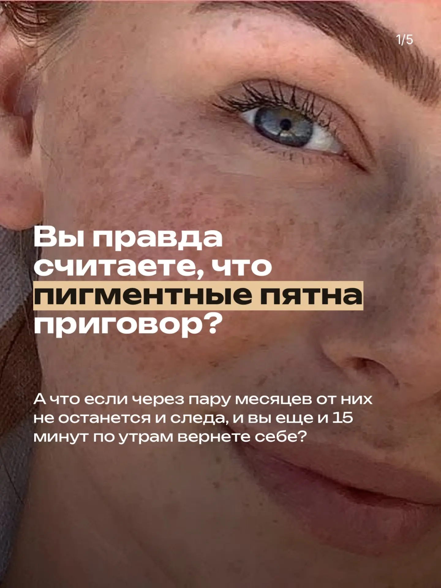 Вы правда считаете, что с этими надоедливыми пигментными пятнами придётся жить вечно? 😤 Что каждый 