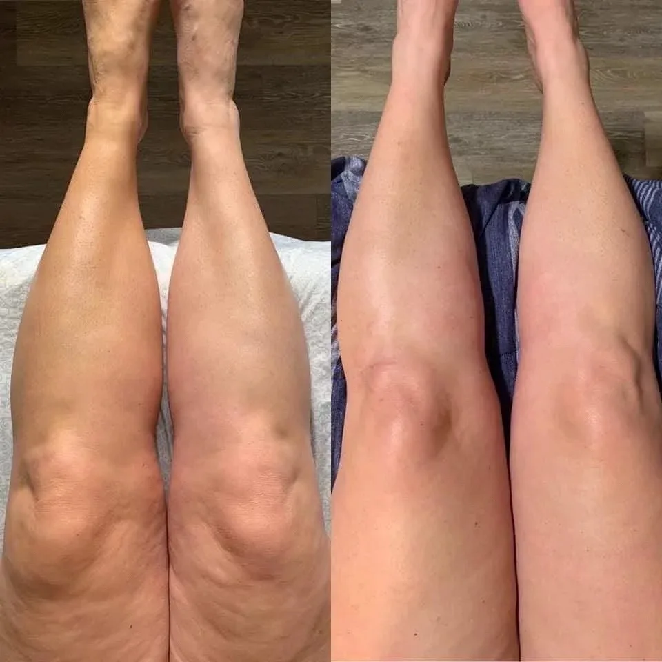 Смотрите какие потрясающие результаты у наших клиентов 🥹😱😍 
Приглашаем вас на аппаратный массаж —