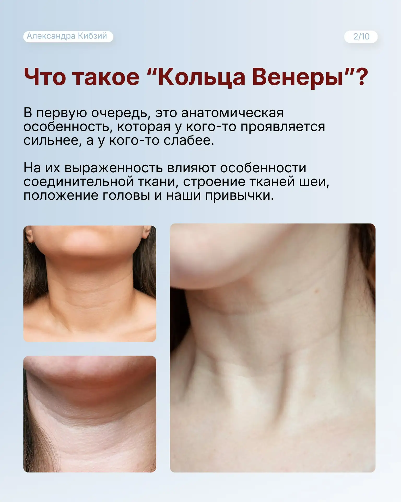 Можно ли избавиться от “колец Венеры” в 40+?