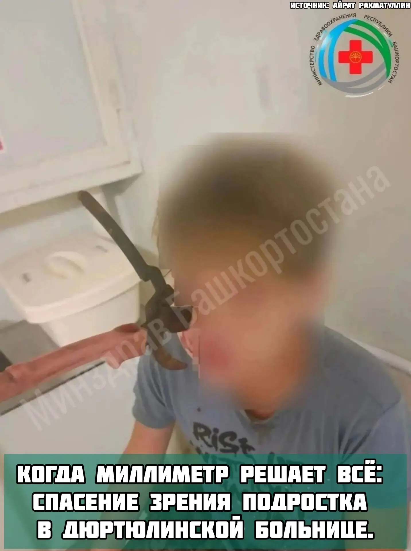 🏥14-летний мальчик получил травму лица садовым секатором, который вошёл в щёку и проник на 3 см в в