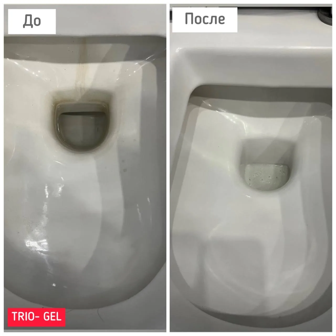 TRIO-GEL: 5 эффективных способов использования 👌