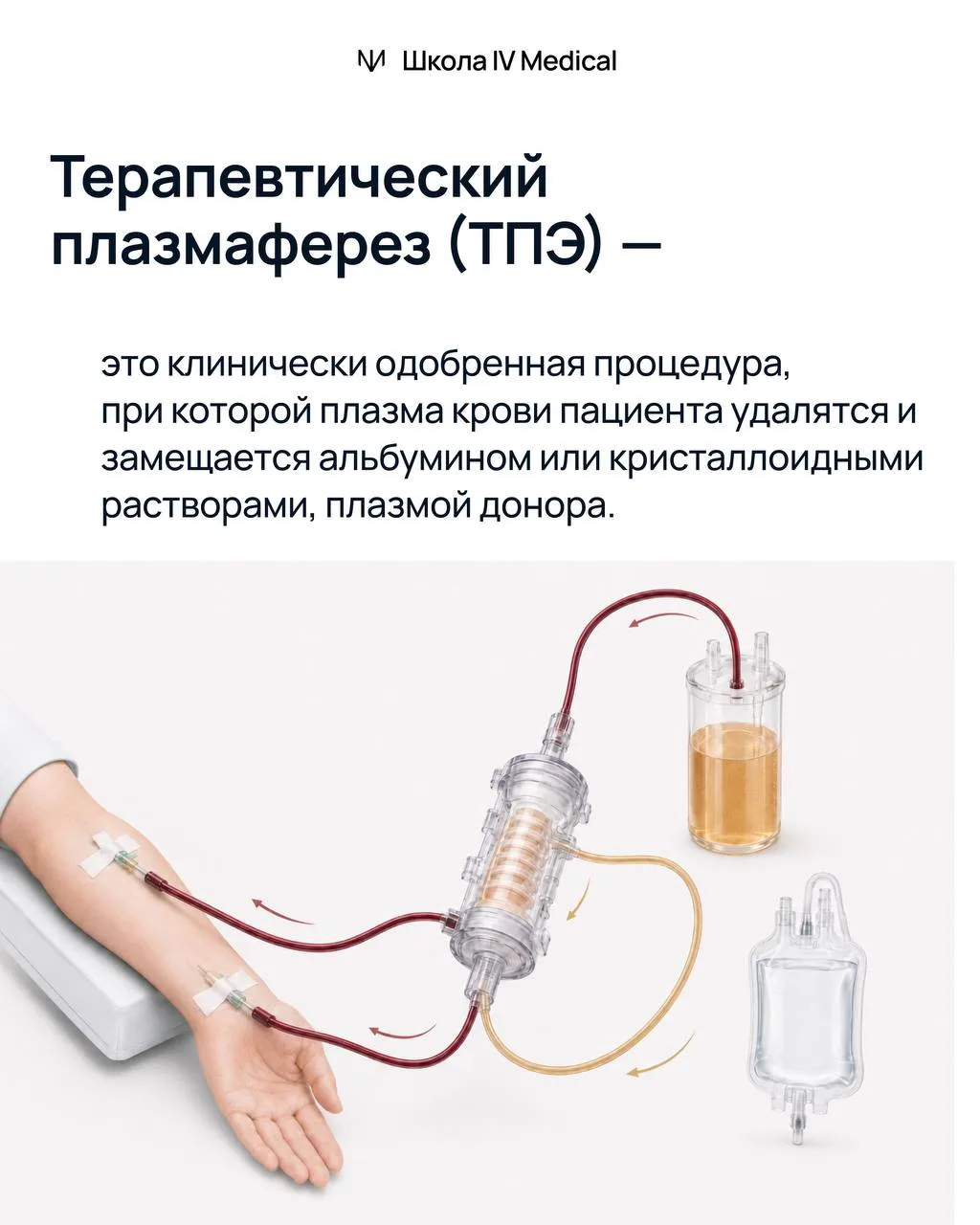 Плазмаферез и anti-age: зачем врачу менять состав циркулирующей среды