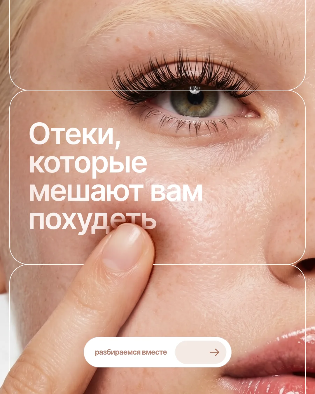 Отеки, которые мешают вам похудеть 🫣