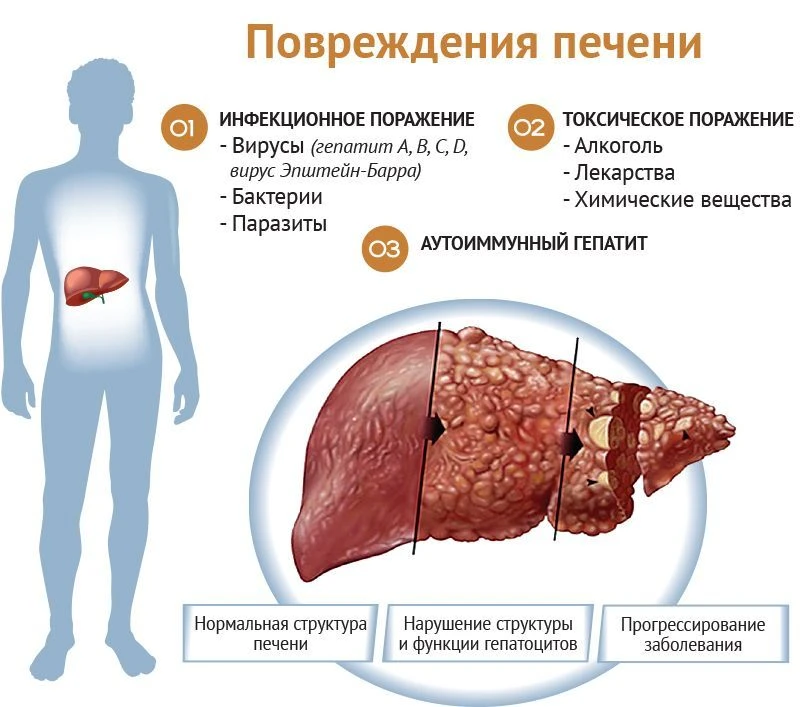 Печень – один из самых трудолюбивых органов нашего тела. Она работает без выходных, очищая кровь и п